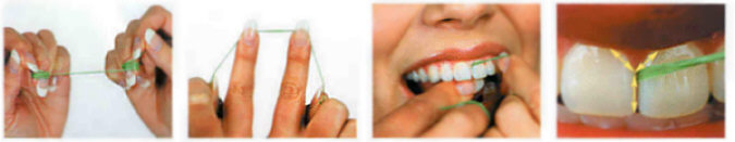 flossing technique.jpg (22692 bytes)